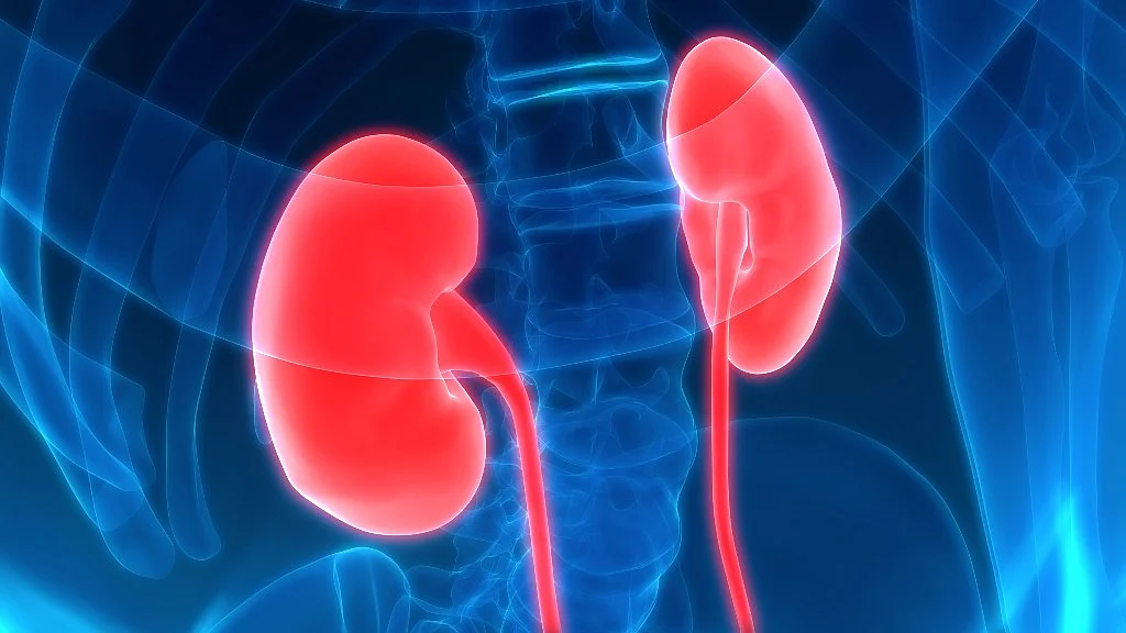 Kidney cancer is a condition in which the kidney cells become malignant and form tumours.