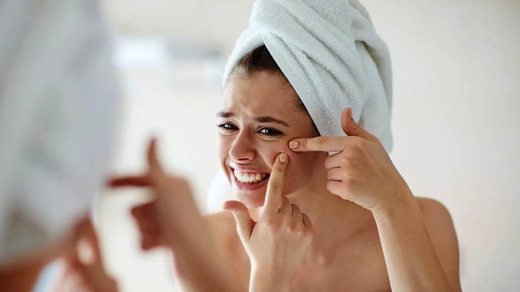 Breakouts, pimples and acne are not due to masturbation and are mainly dependent on hormones.