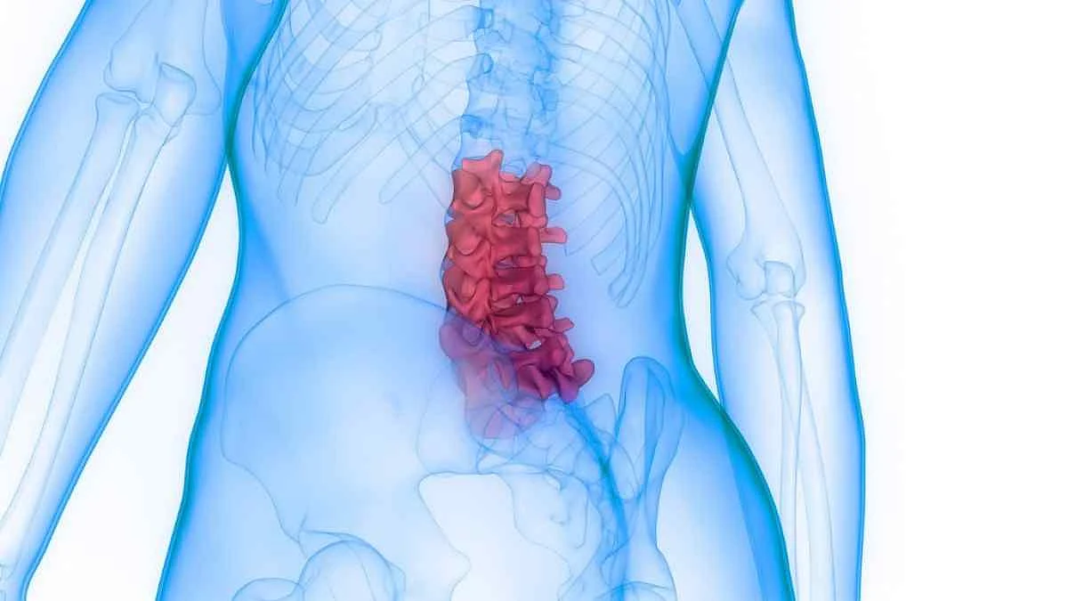 Stressed out people don’t focus on their diet or exercise, further exacerbating their osteoporosis.