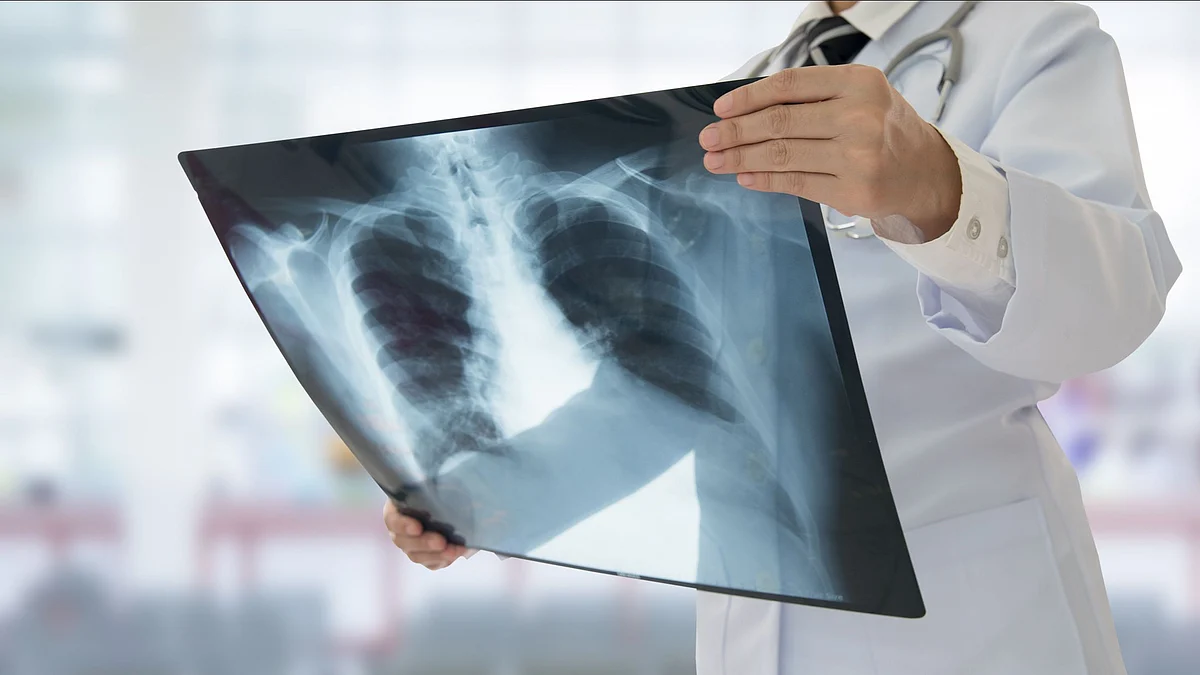 A novel Artificial Intelligence (AI)-based system can dramatically reduce the time needed to process abnormal chest X-rays with critical findings.