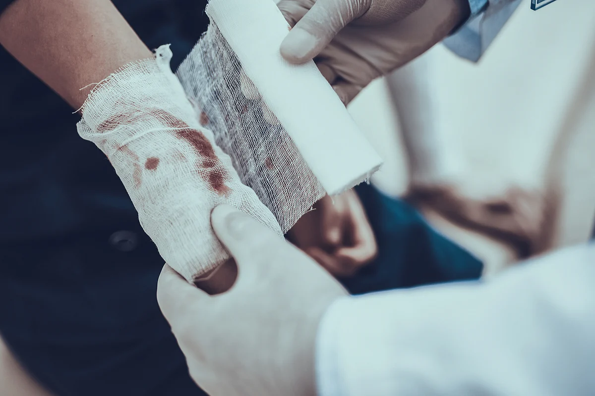 The health ministry recognises that more people die due to burns injuries in India than due to malaria and tuberculosis.