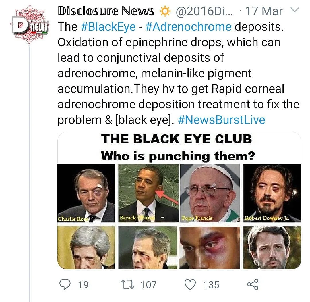 ‘Adrenochrome Eye’: No, Celebs Are Not Injecting Tears of Children