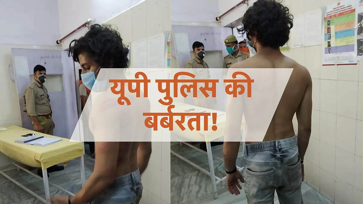 गाड़ी तेज चलाई तो पुलिस ने युवक पर उतारा गुस्सा, मार-मारकर शरीर छलनी कर दिया