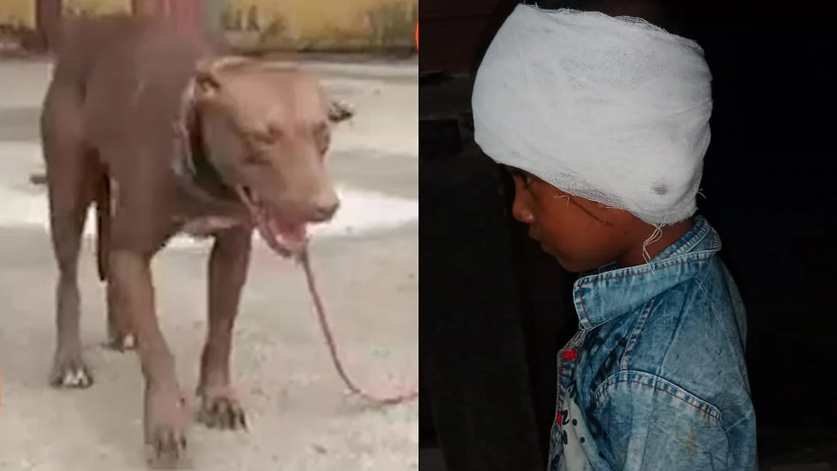 लखनऊ-मेरठ के बाद अब गाजियाबाद में Pitbull का आतंक! पिटबुल कुत्ते ने बच्ची का काट खाया कान
