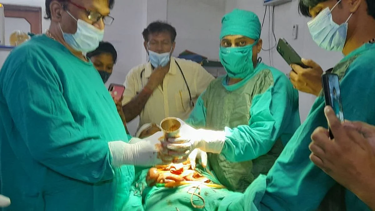 जौनपुर: आंत में फंसा ग्लास बना रहस्य! ऑपरेशन कर निकाला गया, जानें हैरान कर देनी वाली कहानी