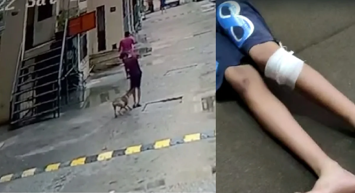 गाजियाबाद: स्ट्रीट डॉग ने बच्चे को काटा, दर्द से बिलबिला उठा मासूम, CCTV आया सामने