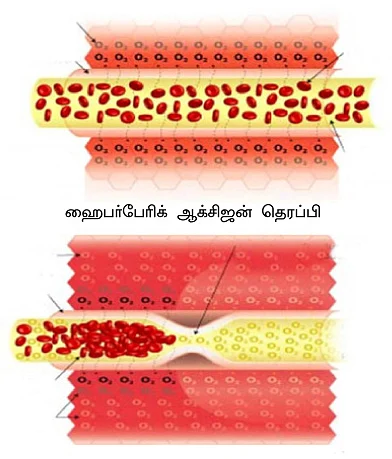 தீராத காயத்துக்கு தீர்வு!