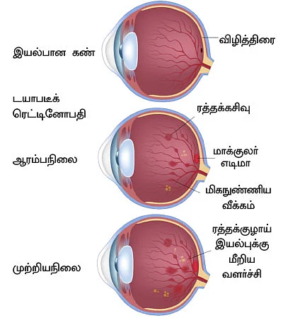 ஸ்வீட் எஸ்கேப் - 9