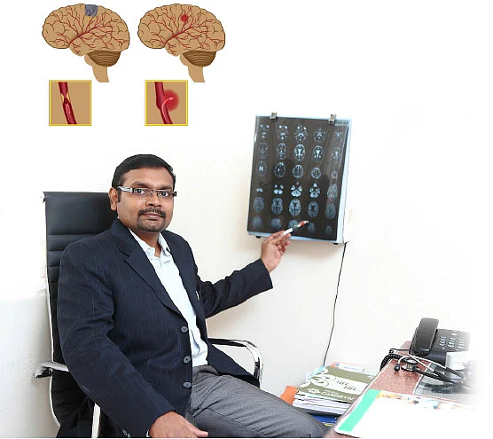 பக்கவாதம் பக்கம் வராமல் தடுக்கலாம்!