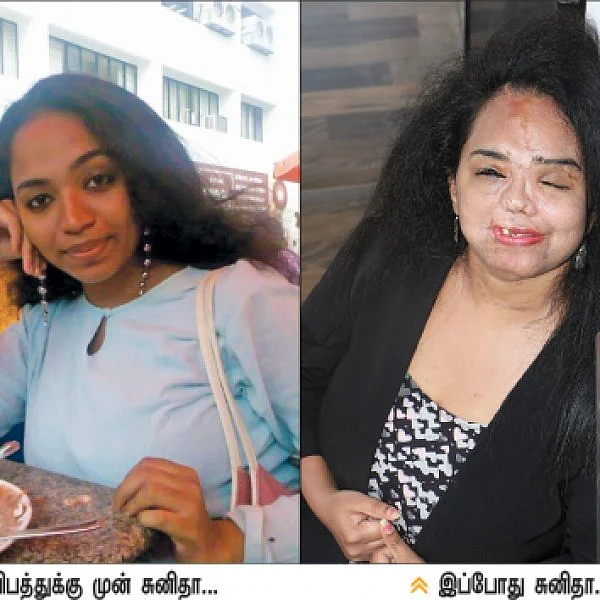கீழே விழுவோம்... எழுந்திருக்கத் தெரிஞ்சிருக்கணும்... அதுதான் வாழ்க்கை! - சுனிதா அடினஸ்