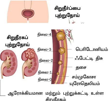 சிறுநீரகம் காப்போம்!