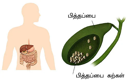 டயாபடீஸ் ரகசியங்களும்... தீர்வும்...
