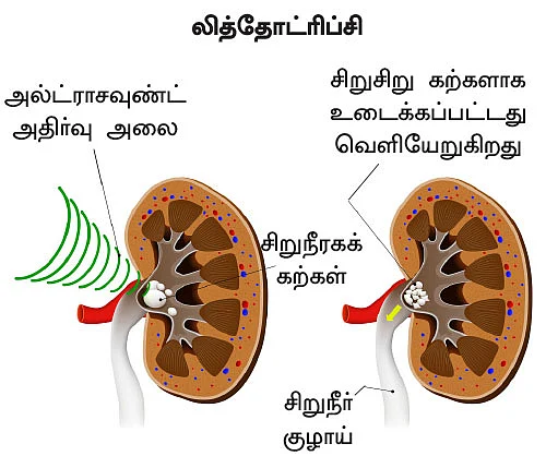 சிறுநீரகம் காப்போம்!