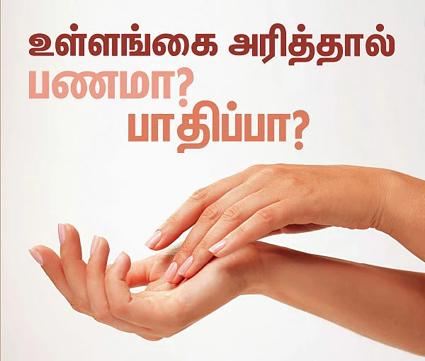 உள்ளங்கை அரித்தால் பணமா? பாதிப்பா?