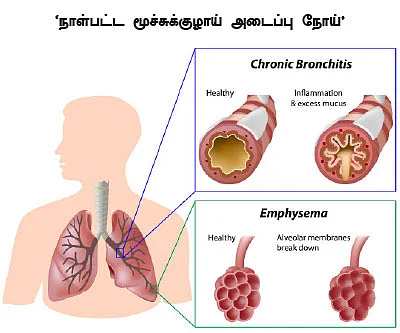 புகையை சுவாசித்தால்...