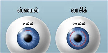 கண்களின் ஸ்மைல்!
