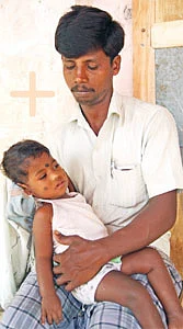 கழுத்து நிற்காத குழந்தை... கைகொடுத்த மருத்துவர்கள்!