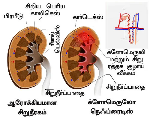 சிறுநீரகம் காப்போம்!