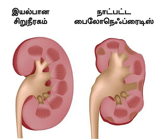 சிறுநீரகம் காப்போம்!