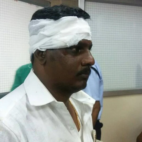 ஆர்.கே.நகரில் ஓ.பி.எஸ் ஆதரவாளர் மண்டை உடைப்பு! சசிகலா ஆதரவாளர் வெறிச்செயல்