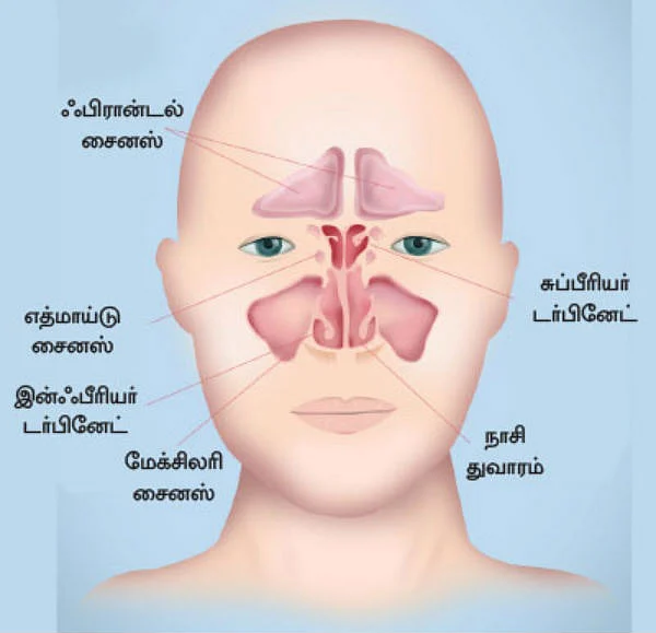 சைனஸ் பிரச்னை தவிர்க்க... தப்பிக்க