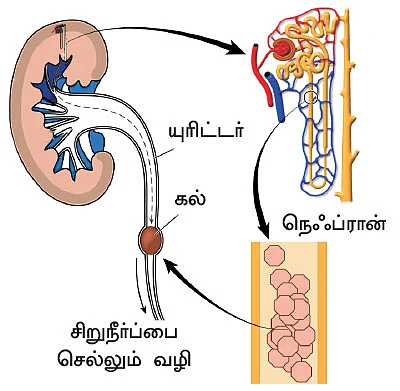 சிறுநீரகம் காப்போம்!