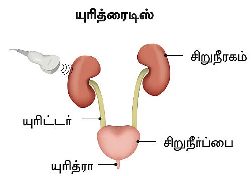 சிறுநீரகம் காப்போம்!