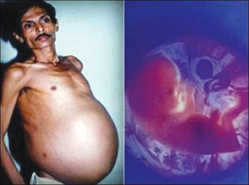 இட்ஸ் எ மெடிக்கல் மிராக்கிள்!