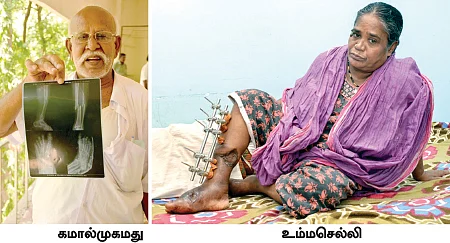 சிவகங்கை ஆஸ்பத்திரிக்கு சர்ஜரி தேவை!