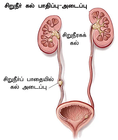 சிறுநீரகம் காப்போம்!