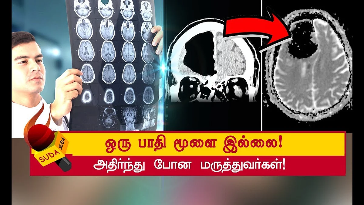 நடுவுல கொஞ்சம் மூளையைக் காணோம்... 84 வயது விந்தை மனிதர்!