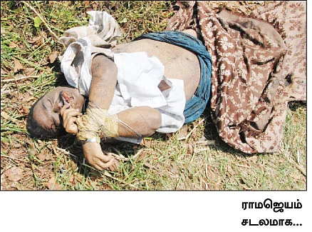 எரித்துக் கொன்றதால் அடித்துக் கொலையா?