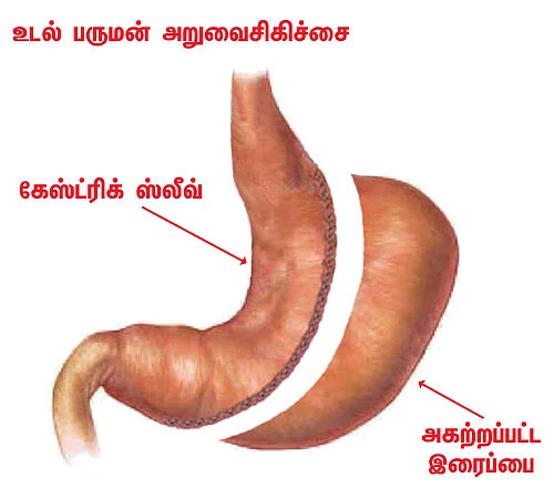 மாதம் ஒரு கிலோ எடை குறைக்கலாம் ஈஸியா!