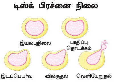 மருந்தில்லா மருத்துவம் - 5
