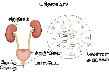 சிறுநீரகம் காப்போம்!