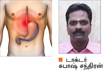 நெஞ்சு எரிச்சலால் அவதியா?