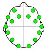 சர்வைவா - 31