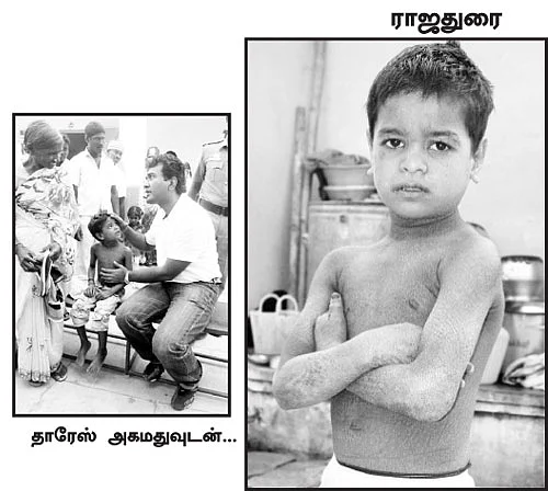 தோல் உரிக்கும் 'பாம்பு' பையன்!
