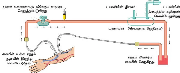 சிறுநீரகம் காப்போம்!