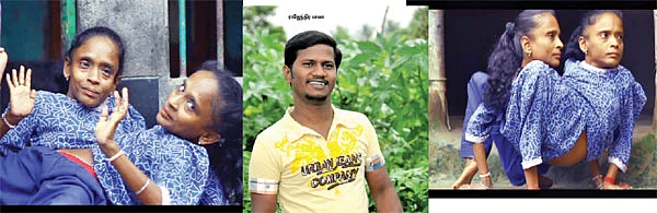 ஓருடல்... ஈருயிர்!