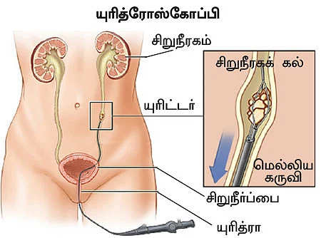 சிறுநீரகம் காப்போம்!
