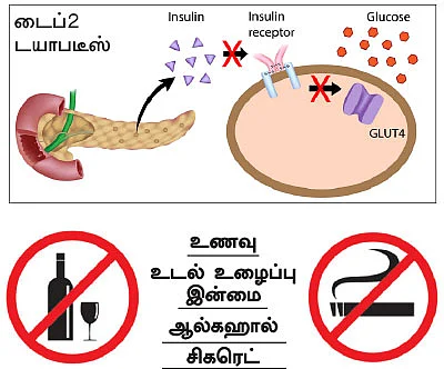 டயாபடீஸ் ரகசியங்களும்... தீர்வும்...