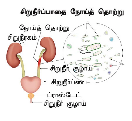 சிறுநீரகம் காப்போம்!