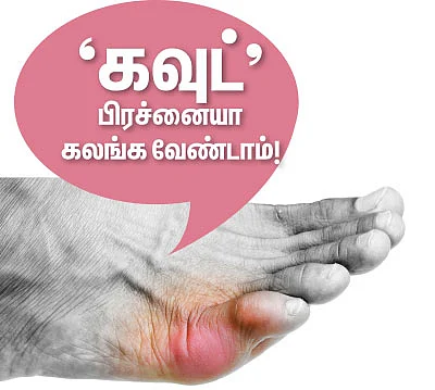 கவுட் பிரச்னையா கலங்க வேண்டாம்!