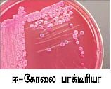 தாம்பத்ய வாழ்க்கையை தடுமாற வைக்கும் ஈ-கோலை...!