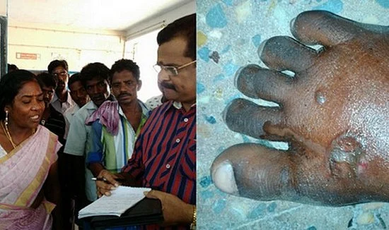 பள்ளி மாணவர்களுக்கு சூடுவைத்த ஆசிரியை கைது!
