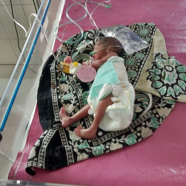 இறந்ததாக அரசு டாக்டர் சான்றிதழ் : புதைக்கும் நேரத்தில் குழந்தைக்கு உயிர் வந்தது!