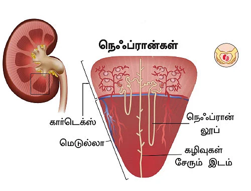 சிறுநீரகம் காப்போம்!