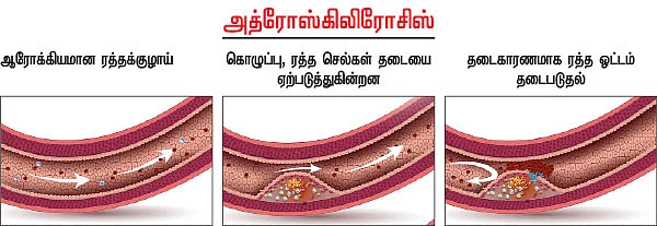 இனி நோ டென்ஷன்
