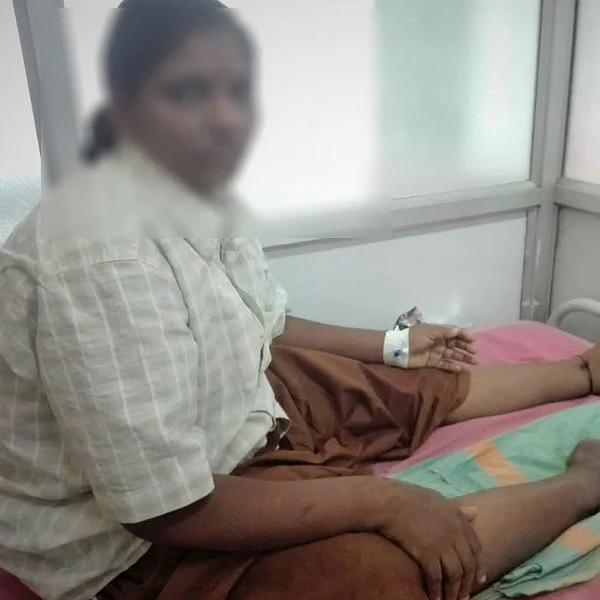 கர்ப்பப்பை கட்டி ஆப்ரேஷனுக்கு சென்ற பெண் காலை இழந்த பரிதாபம் - விருதுநகர் அரசு மருத்துவர்களின் அலட்சியம்..!